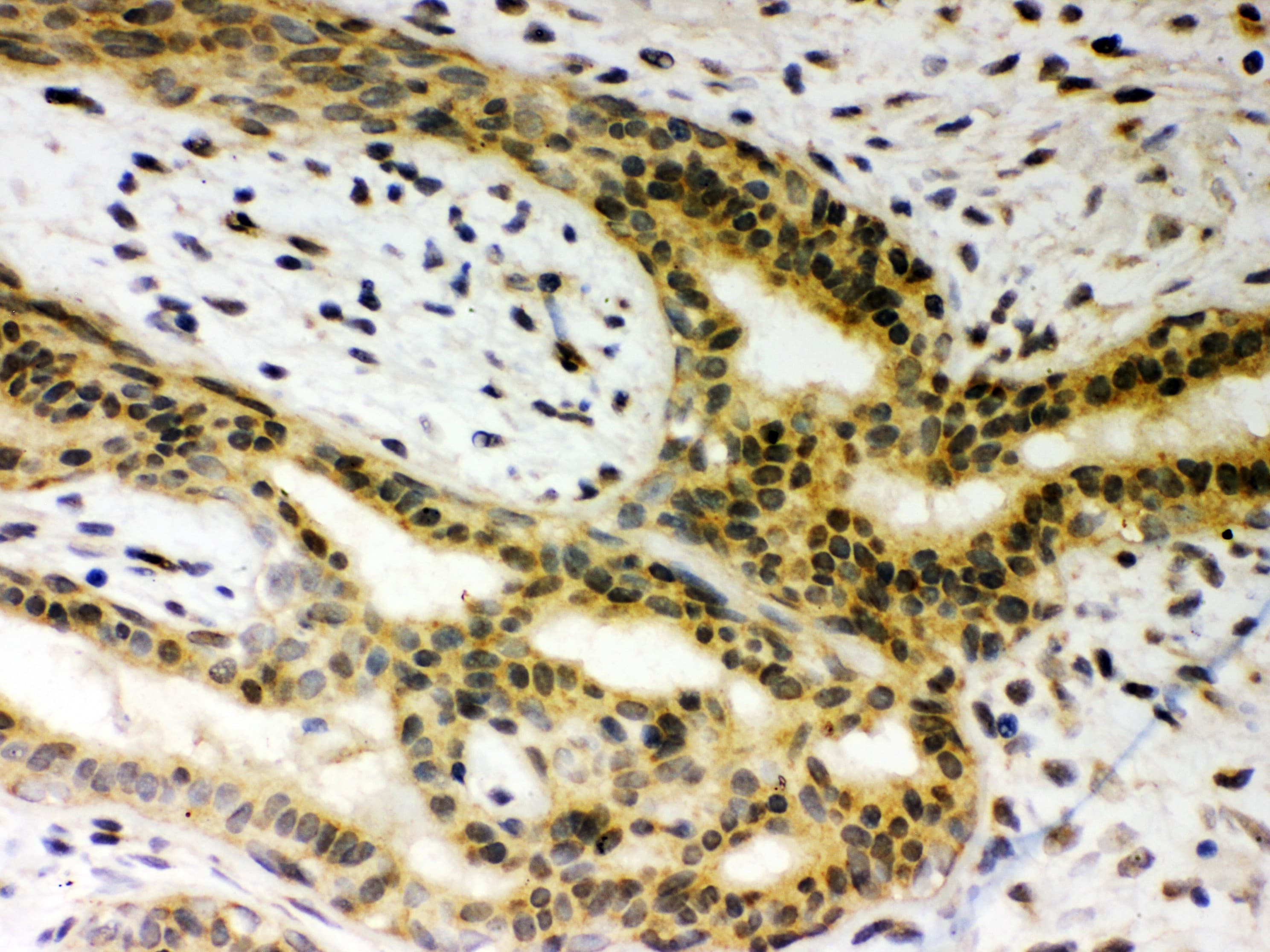 SIRT6 / Sirtuin 6 Antibody (aa14-180)