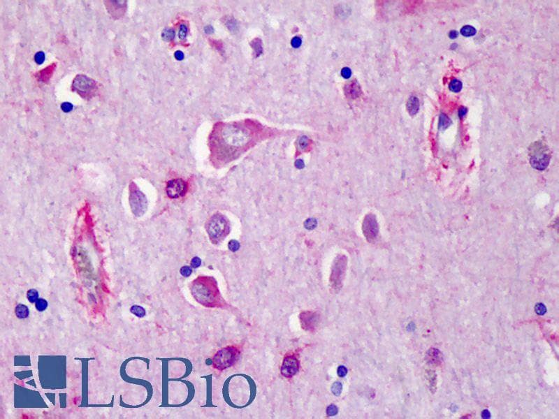 IHC-plus™ Polyclonal Rabbit anti-Human Neurotrypsin Antibody (IHC, IF, WB)