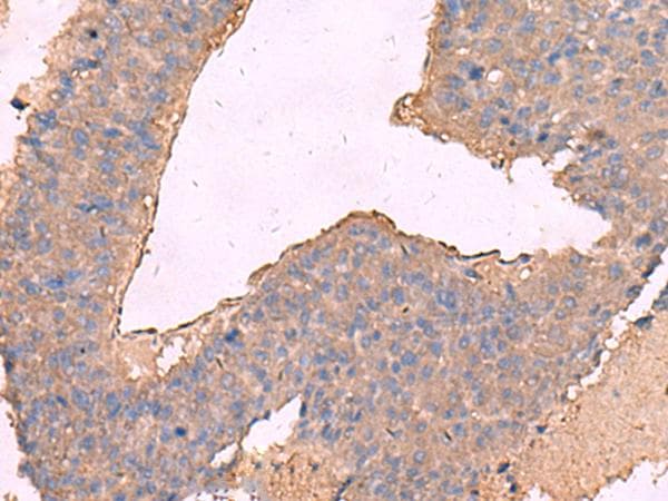 KCNN2 Antibody