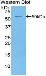 NT5E / eNT / CD73 Antibody (aa29-550)