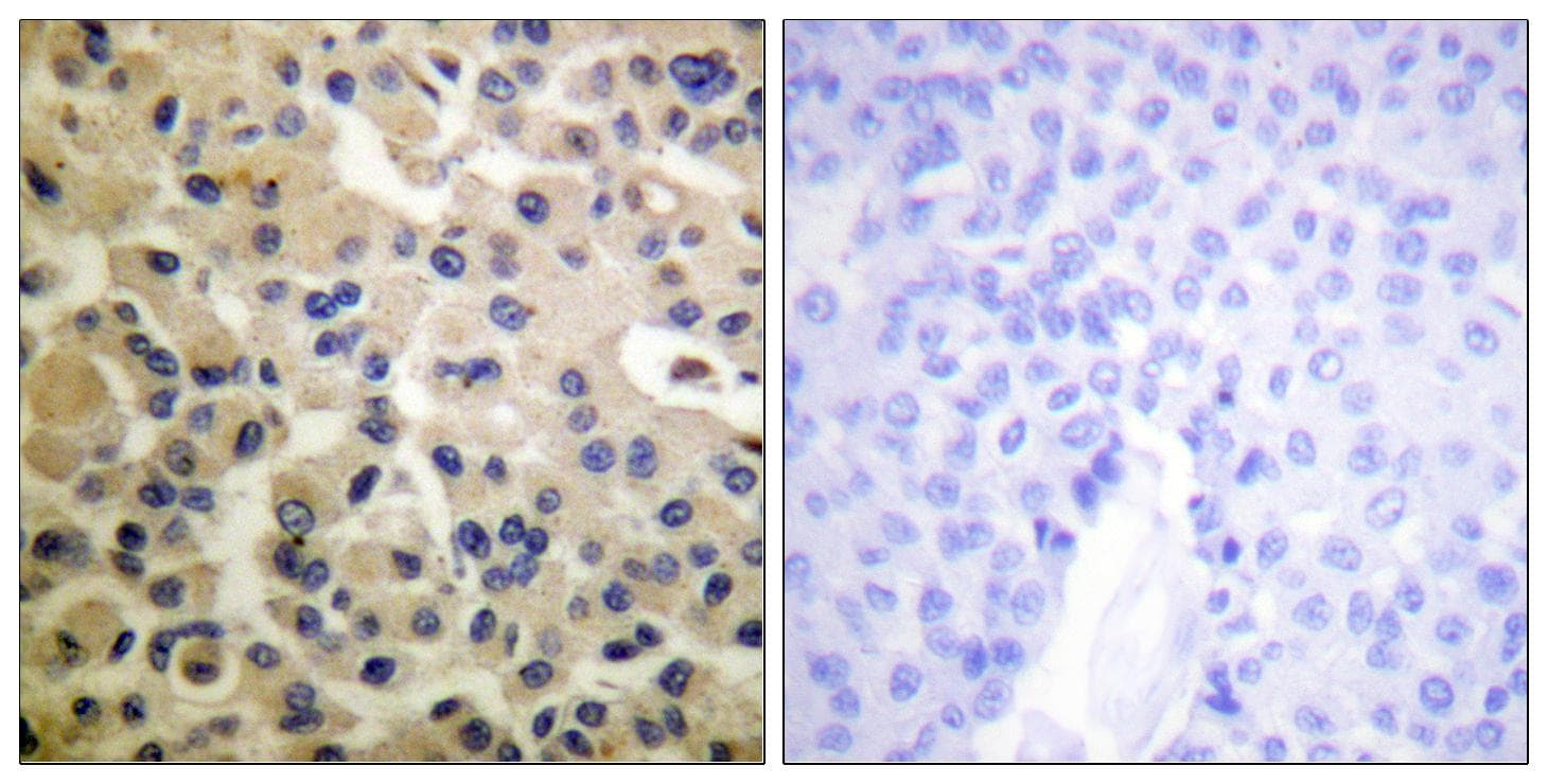 Polyclonal Rabbit anti-Human CHUK / IKKA / IKK Alpha Antibody (phospho-Ser180/181, IHC, IF, WB)