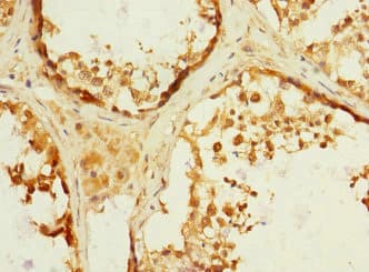 Polyclonal Rabbit anti-Human ADAM19 Antibody (IHC)