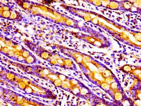 Polyclonal Rabbit anti-Human MPST Antibody (IHC, IF)
