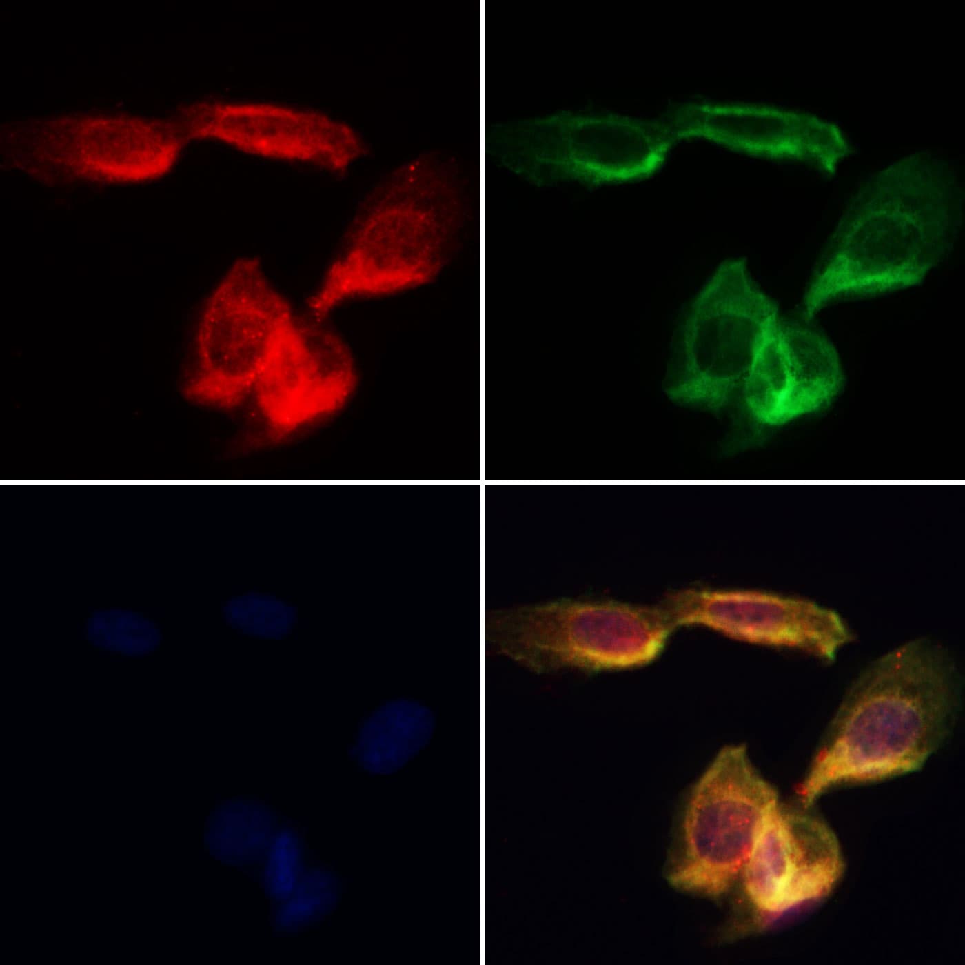 ERGIC2 Antibody