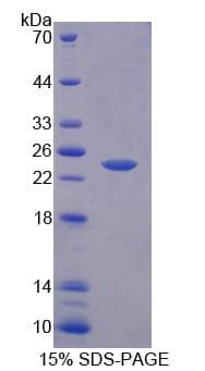 Rat PTPRA / RPTP-Alpha Protein (Recombinant)