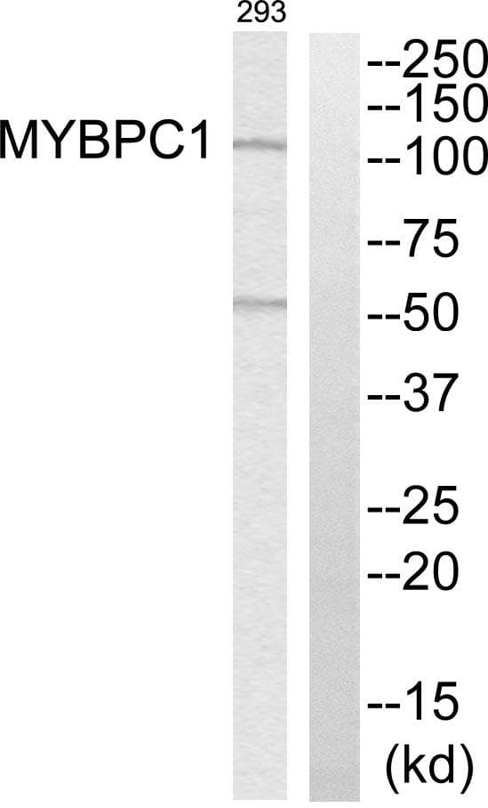 Polyclonal Rabbit anti-Human MYBPC1 Antibody (WB)