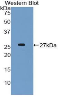 NUP98 Antibody (aa568-776)