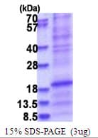 Human SFTPD / Surfactant Protein D (Recombinant His)