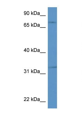 SCG2 / Secretogranin II Antibody (aa400-449)