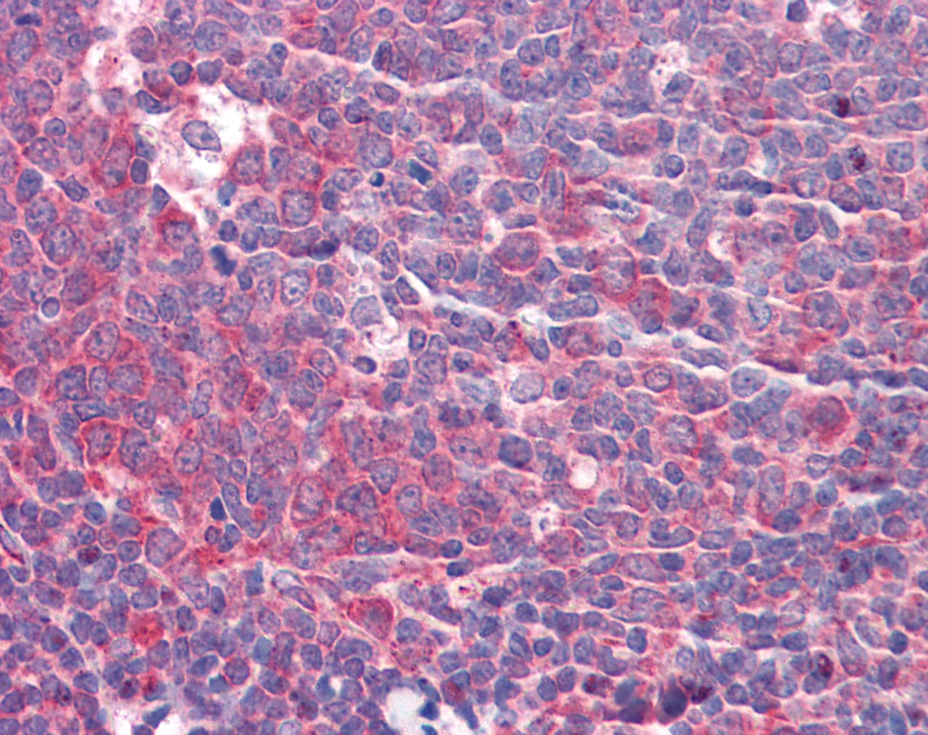 Polyclonal Rabbit anti-Human GOLM1 / GP73 / GOLPH2 Antibody (aa38-87, IHC, WB)