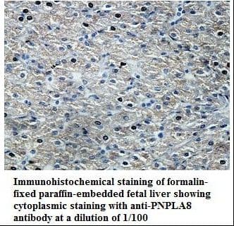PNPLA8 Antibody (aa129-358)