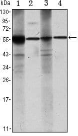 Monoclonal Mouse anti-Human ALDH1A1 / ALDH1 Antibody (clone 5A11, IHC, WB)