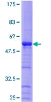 Human HAUS1 / CCDC5 Protein (Recombinant GST)