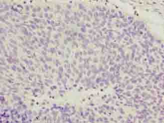 Polyclonal Rabbit anti-Human COPZ1 Antibody (IHC, WB)