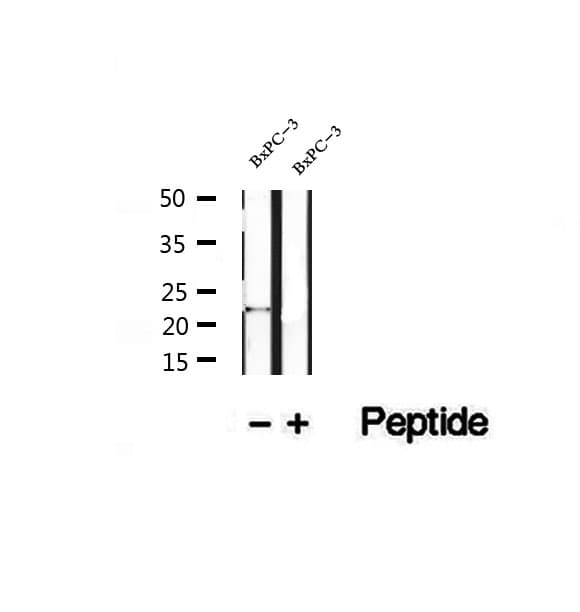 Polyclonal Rabbit anti-Human REEP6 Antibody (IHC, WB)