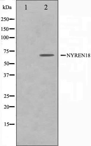 Polyclonal Rabbit anti-Human NUB1 Antibody (IHC, IF, WB)