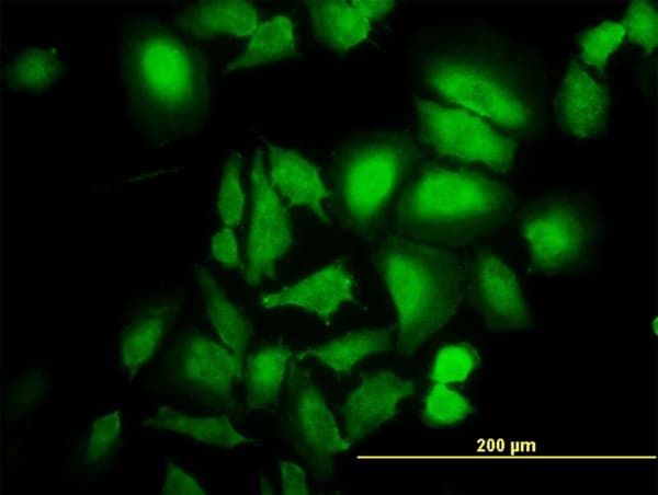 Monoclonal Mouse anti-Human ABL2 Antibody (clone 5C6, IF, WB)