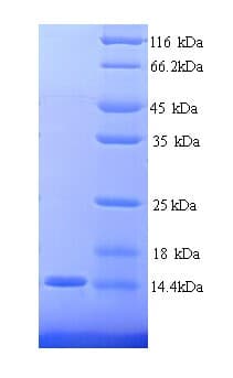 Human CEACAM4 Protein (Recombinant His)