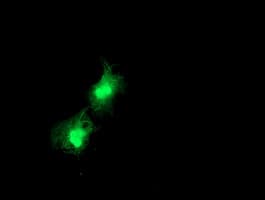 Thymidylate Kinase Antibody (clone OTI1E6)