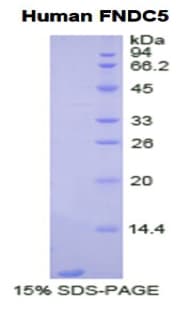 Human FNDC5 / Irisin Protein (Recombinant His)