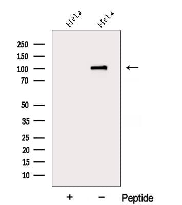 DDX10 Antibody
