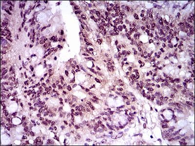 Monoclonal Mouse anti-Human TBXT / T / Brachyury Antibody (clone 1H9A2, Amino Acid: 257-309, IHC, WB)