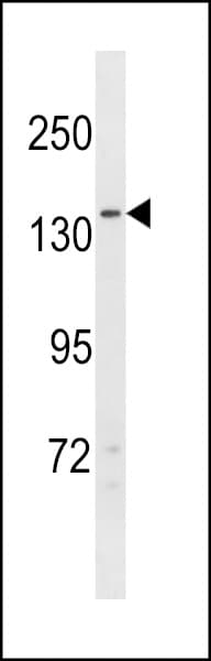 NPC1L1 Antibody (aa294-323)