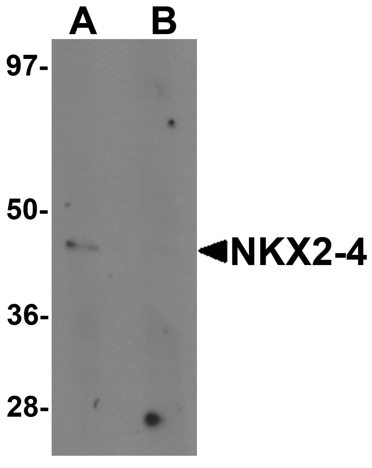 IHC-plus™ NKX2-4 Antibody