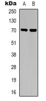 TGFBR2 Antibody (Internal)