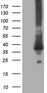 RAB23 Antibody (aa1-234, clone OTI2F3)