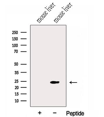 Gpnat1 / GNPNAT1 Antibody