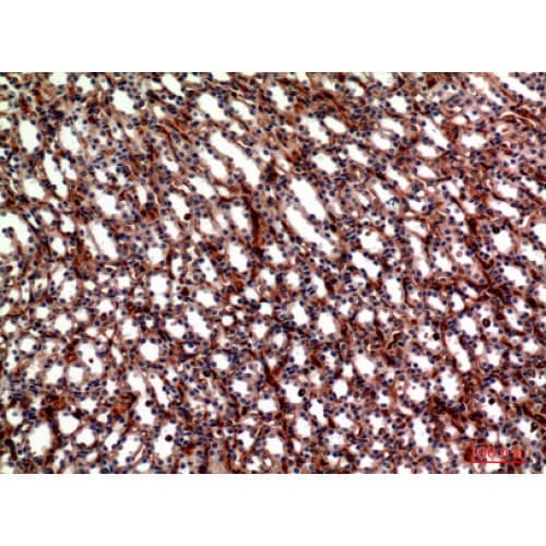 ITGA5/Integrin Alpha 5/CD49e Antibody (561-610 aa, Internal)
