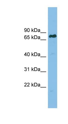 Polyclonal Rabbit anti-Human LBR / Lamin B Receptor Antibody (aa503-552, IHC, WB)