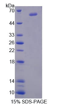 Human NCAM2 Protein (Recombinant His-GST)