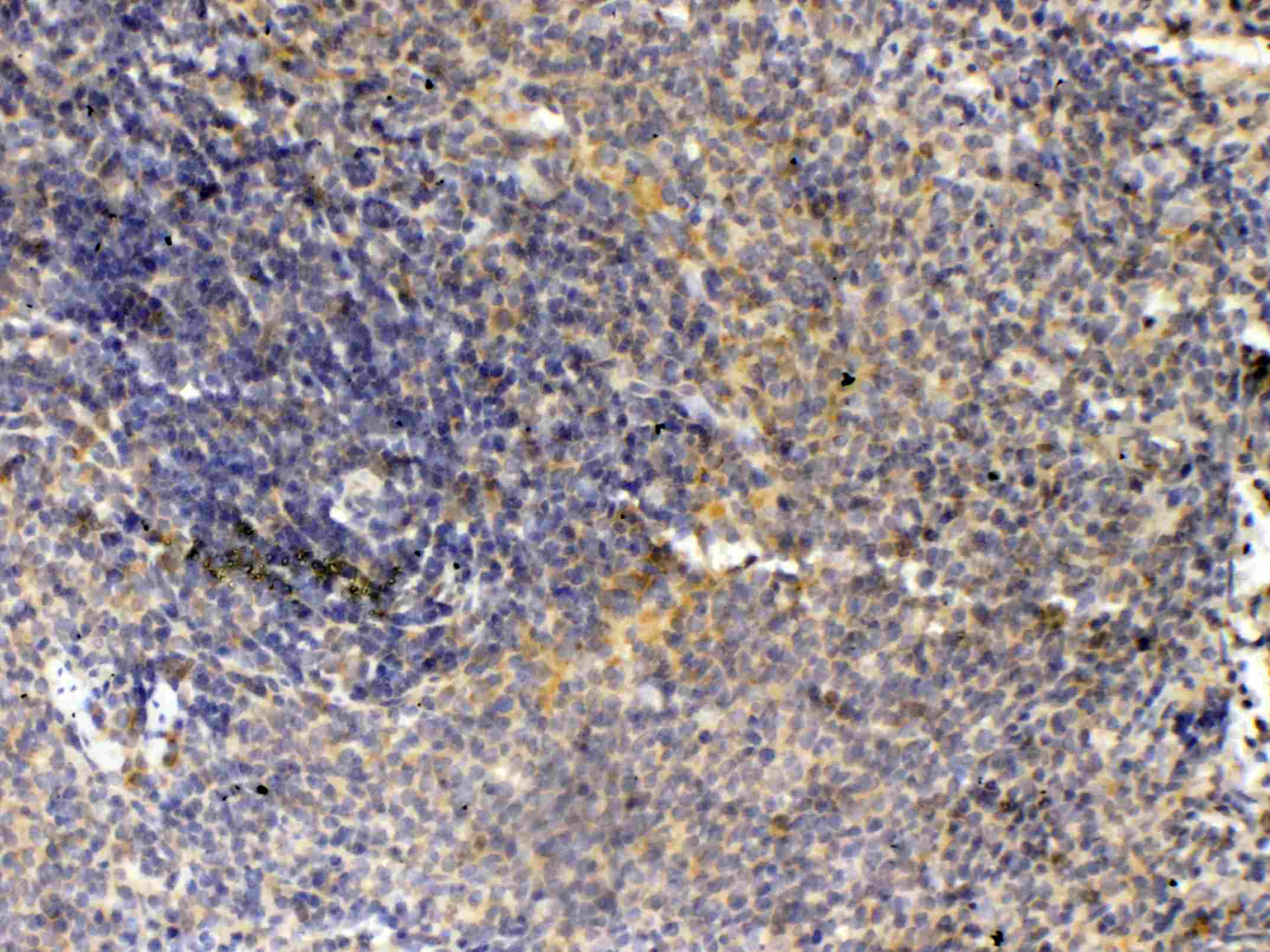THPO / TPO / Thrombopoietin Antibody