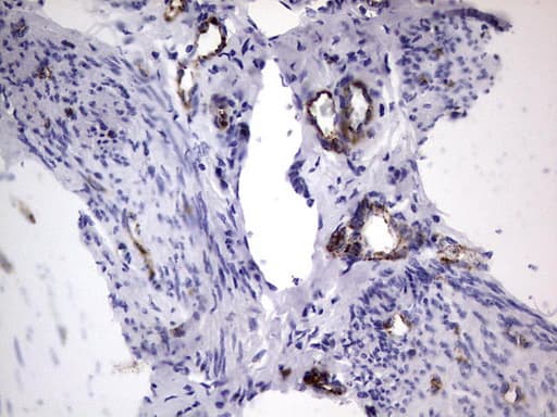 VWF / Von Willebrand Factor Antibody (aa764-1263, clone OTI7G3, Carrier-free)