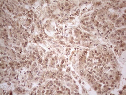 Monoclonal Mouse anti-Human PPP1CA / PP1-Alpha Antibody (clone OTI6E5, IHC, WB)
