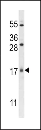 SZRD1 / C1orf144 Antibody (aa7-36)