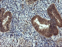 Monoclonal Mouse anti-Human TRIM44 Antibody (clone OTI1E10, IHC, IF, WB)