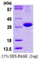 Human DNAJB8 Protein (Recombinant His)