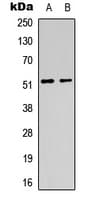 Polyclonal Rabbit anti-Human CHRM1 / M1 Antibody (Internal, WB)