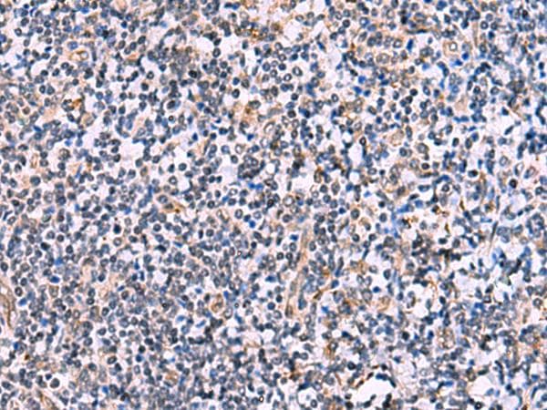 MIBP / ITGB1BP3 Antibody