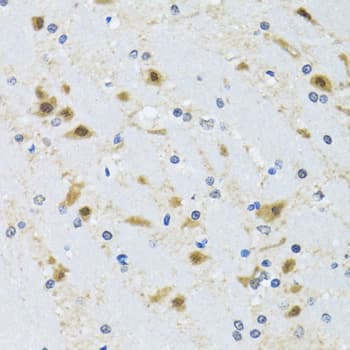 CCT4 / SRB Antibody