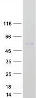 Human TBX19 / TPIT Protein (Recombinant Myc-DDK (Flag))