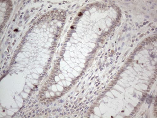 ZNF69 Antibody (clone OTI4A4)