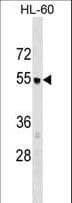 AP3M1 Antibody (aa390-418)