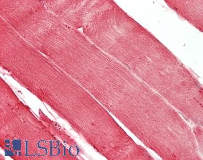 IHC-plus™ MB / Myoglobin Antibody (aa 2-154)