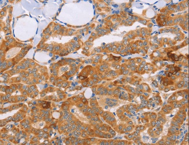 CARD6 Antibody