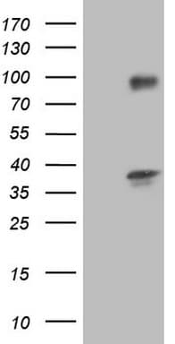 Monoclonal Mouse anti-Human TACC2 Antibody (clone OTI4A6, aa727-1026, WB)