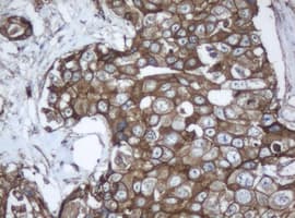 PPT1 / CLN1 Antibody (clone OTI1F10)